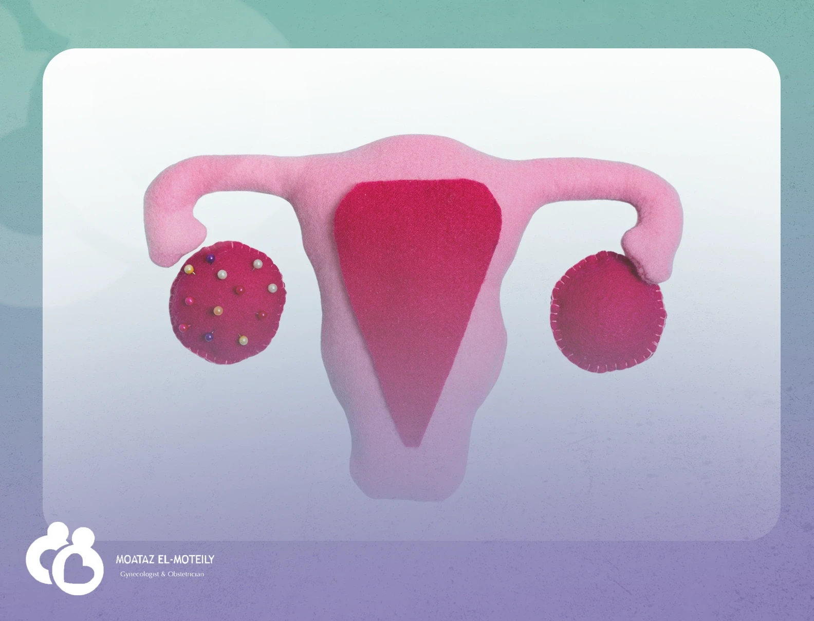 أورام الرحم والمبيضين